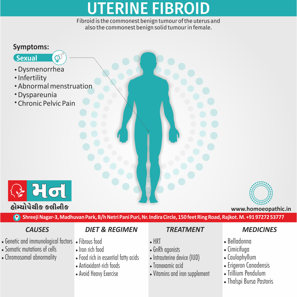 Uterine Fibroid Definition Symptoms Cause Diet Regimen Homeopathic Medicine Homeopath Treatment in Rajkot India