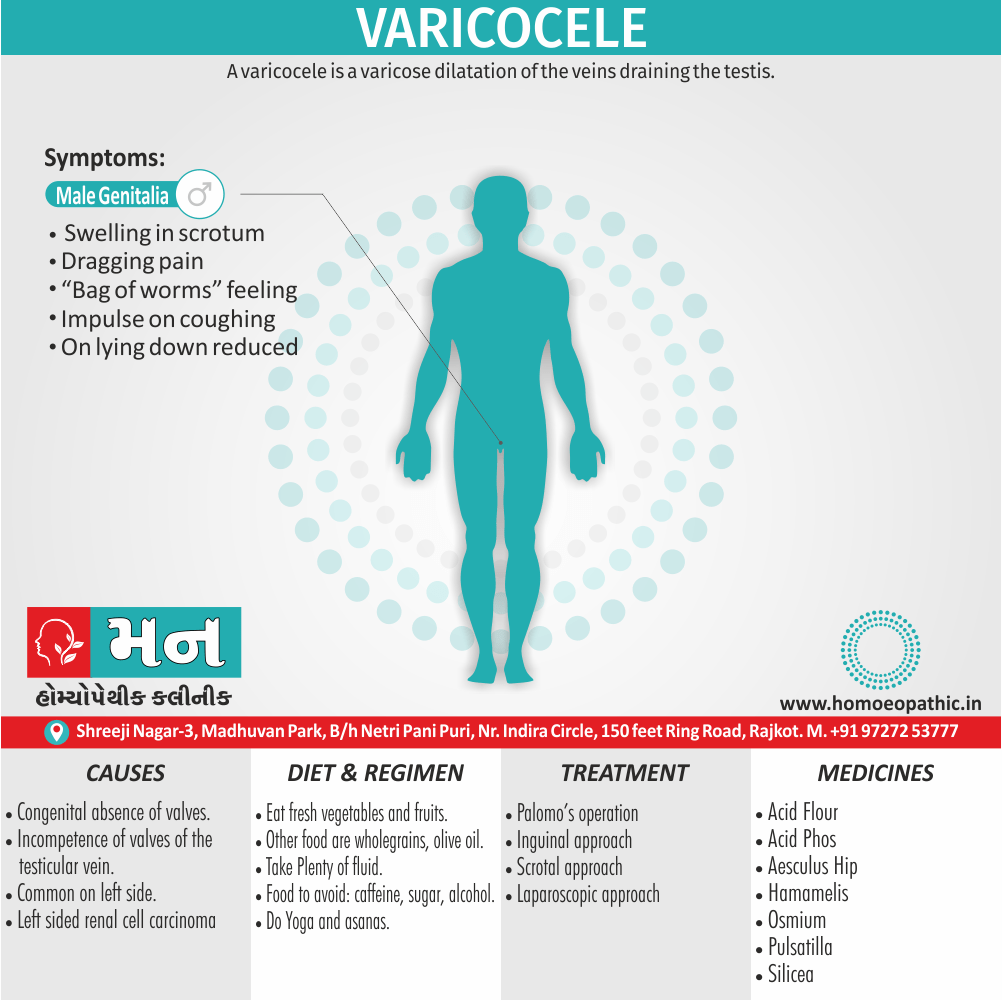 Varicocele Definition Symptoms Cause Diet Homeopathic Medicine Treatment Homeopathy Doctor Clinic in Rajkot Gujarat India