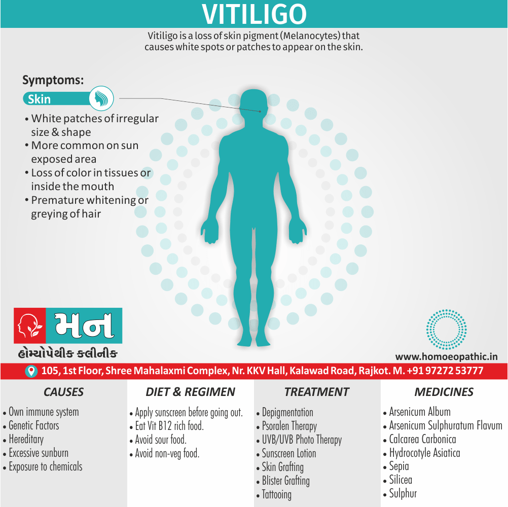 Vitiligo - Mann Homeopathy Clinic Rajkot